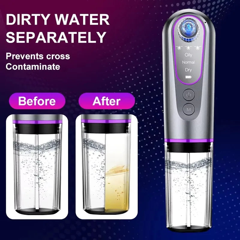 Electric Facial Vacuum Cleaner Professional 6 Suction Heads   and Blackhead Extractor for All Skin Types skin care