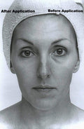Marli Collagen Lifting Facial Kit with Sun Damage Repair Cream-0